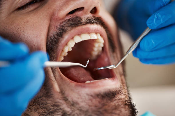 Best Walk-In Emergency Dentist in Mountain City, TN